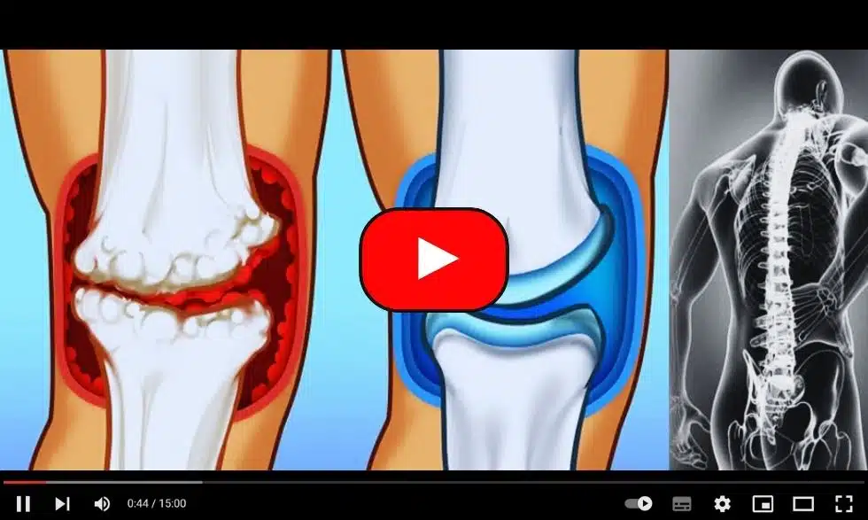 Joint-pain-video-thumbnail